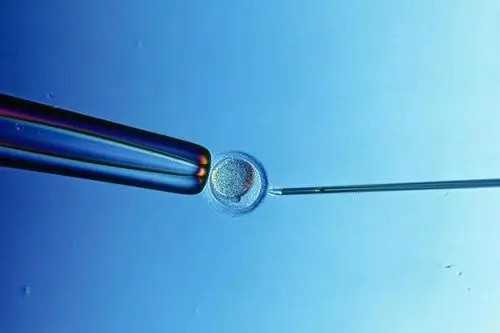 杭州女士求精助孕，杭州试管