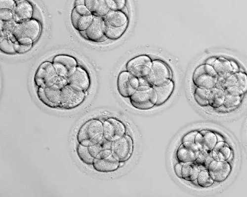 浙江供卵十二万_正规靠谱代孕网,嘉兴民营机构三代试管包生男孩多少钱,附三代