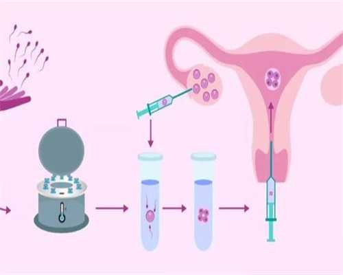 温州单身男人可以做试管婴儿吗多少钱啊