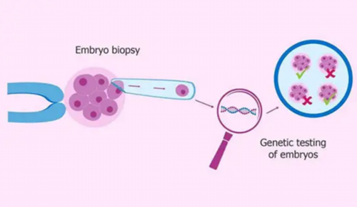 我的试管之路（2）订方案2026.2