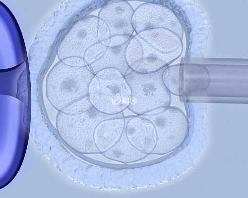嘉兴三代试管包成功-浙江做第三代试管哪家好
