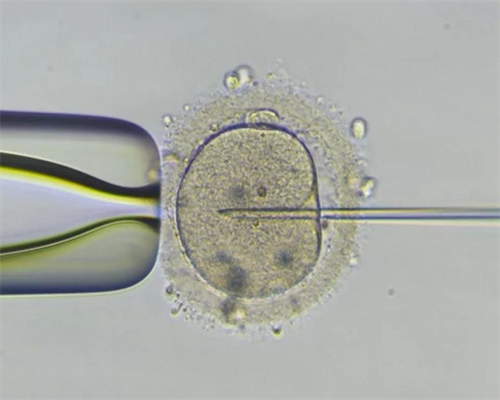 试管代孕借卵_试管生男孩女孩概率,试管微刺激方案成功率高吗？