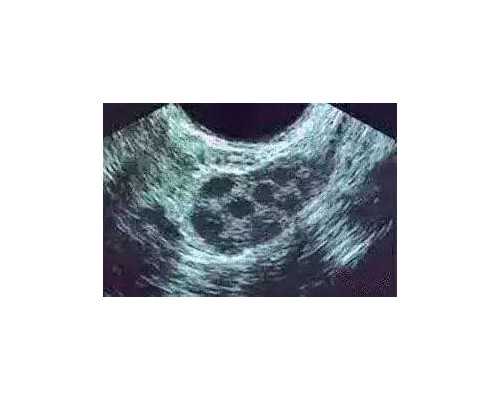 乌克兰LADA医院生殖医学专家：Kaleeva Alla Olegovna医生