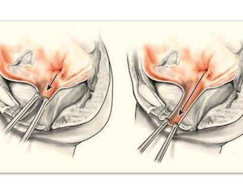 试管代孕移植能吃豆腐干吗？试管代孕移植能吃豆腐干吗有影响吗？