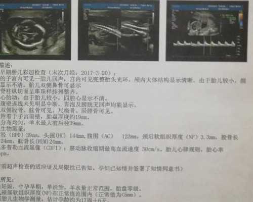 金华三代试管主要筛查什么 浙江做第三代试管哪家好