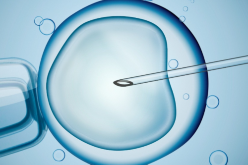 助孕机构医院，克氏综合症是做第三代试管婴儿吗